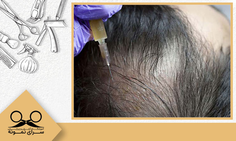 ترمیم مو به روش PRP چگونه انجام می شود؟ پاسخ در سایت هیرآکادمی