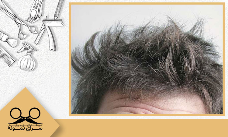 راه جلوگیری از وز شدن مو در سایت هیرآکادمی