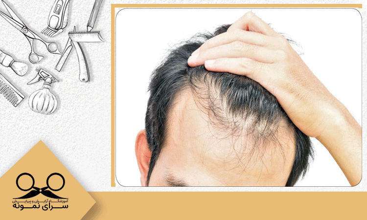 چگونگی تقویت پیاز مو