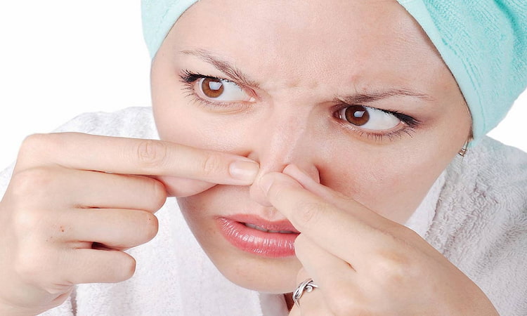 روش های مقابله با جوش سر سیاه