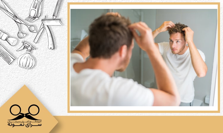چرب شدن موی سر مردان