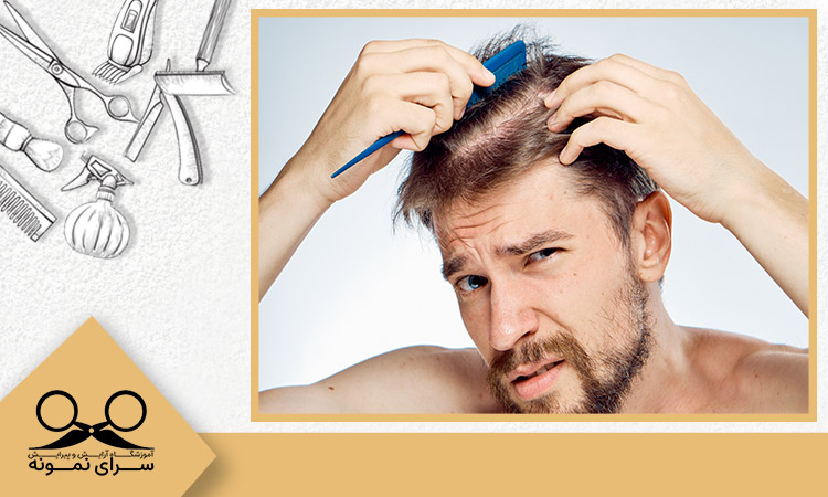 راه های پرپشتی موی مردانه