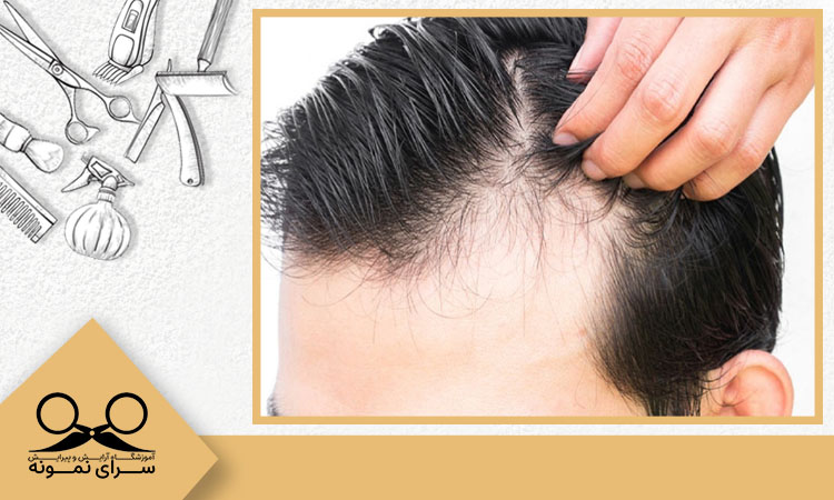 تاثیرات استرس بر پوشت و مو
