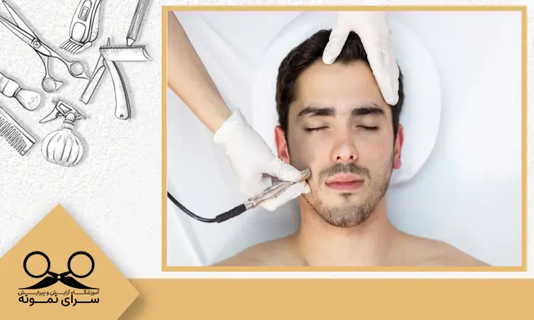 میکرودرم آبریژن